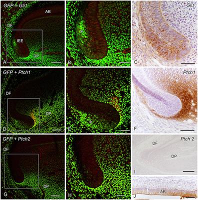 The Sonic Hedgehog–Patched–Gli Signaling Pathway Maintains Dental Epithelial and Pulp Stem/Progenitor Cells and Regulates the Function of Odontoblasts